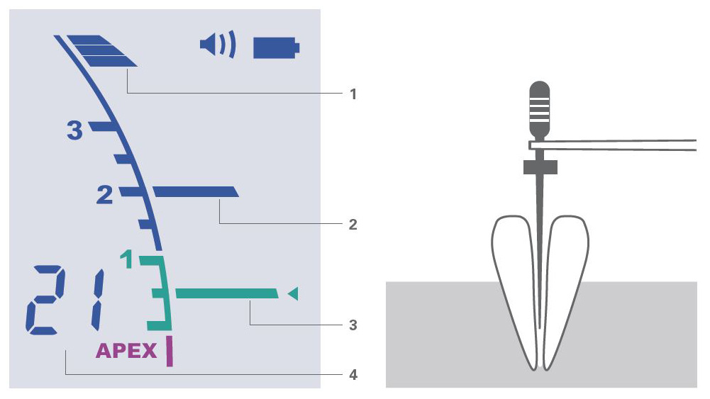 Root ZX Mini | Apex Locater