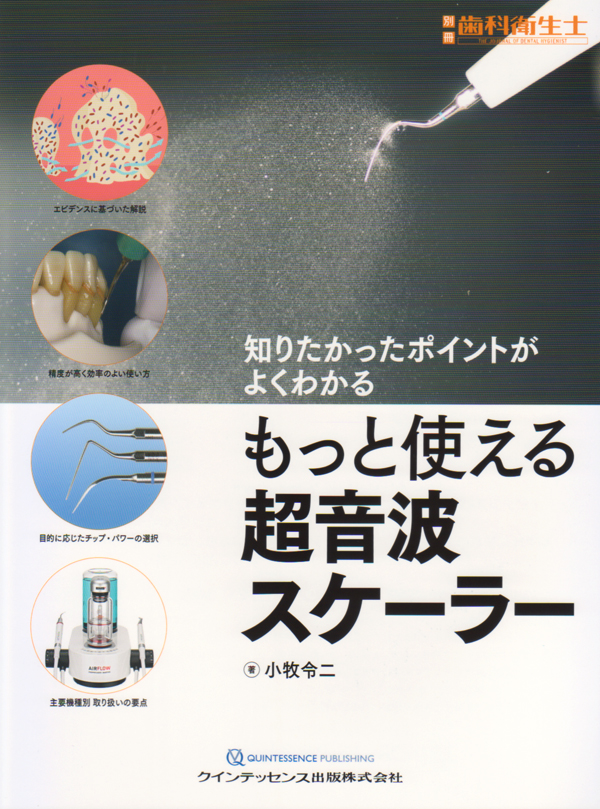 別冊 歯科衛生士 もっと使える超音波スケーラー 知りたかったポイント