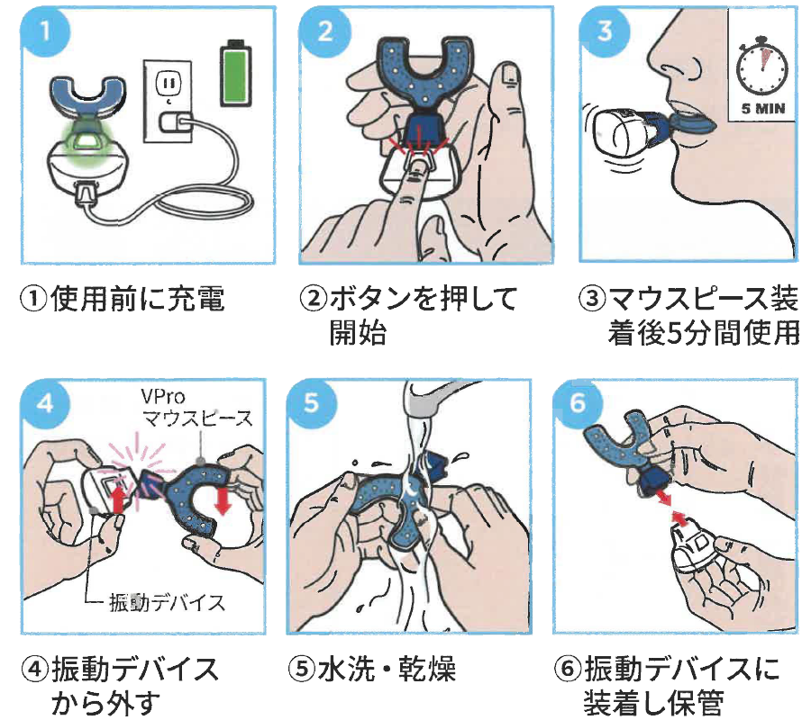神戸市灘区 マウスピース矯正 シュアスマイル｜うしじま歯科・矯正歯科