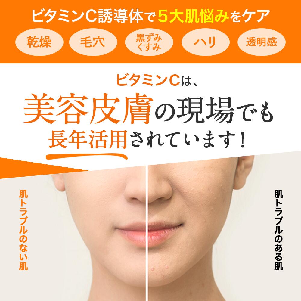 VC ゲル ビタミンC オールインワン ジェル 高浸透型 APPS ハイドロ